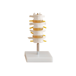 Normal lumbar vertebrae combination (four sections)